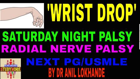 Nextneet Pgusmle Geeta Serieswrist Dropradial Nerve Or Saturday