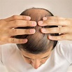 【男性脫髮原因】男士脫髮日常護理方法：改善脫髮問題 - HLHG