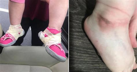 mom is furious after daycare tapes her daughter s shoes to her ankles