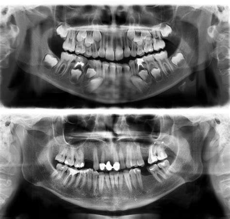 Interesting X Rays And Scans Others