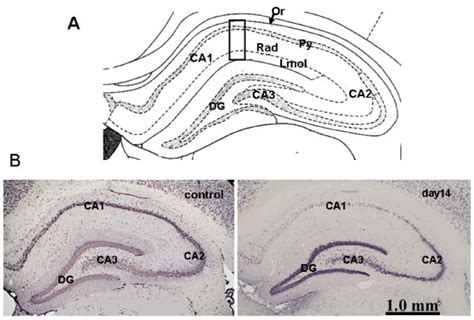 Neuronal Cell Death Only In Ca1 Of Hippocampus A Shows The Structure