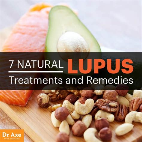 7 Natural Lupus Treatments Natural Remedies Remedies Herbal Remedies