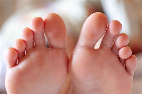 Are Covid Toes A Real Symptom Of The Coronavirus Live Science