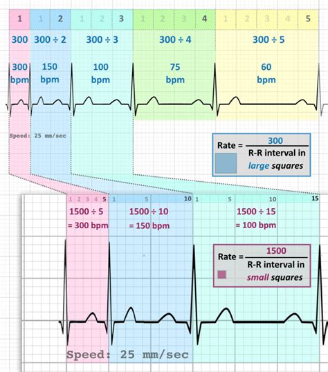 Ekg Heart Rate Conversion Chart