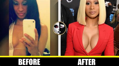 Cardi B Plastic Surgery Before And After Breast Implants Nose Job