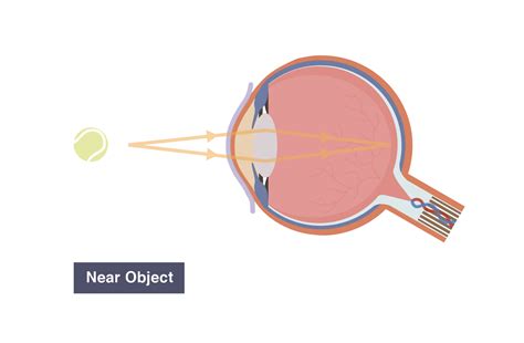 Igcse Biology 2017 292 Understand The Function Of The Eye In
