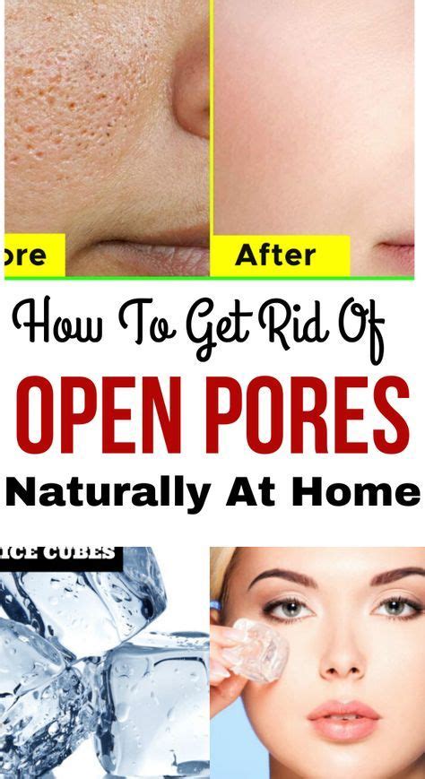 Know About How To Get Rid Of Open Pores On Face This Natural