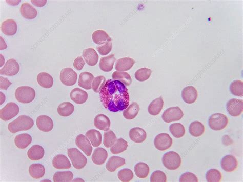 Eosinophilic Leucocyte Lm Stock Image C0435159 Science Photo