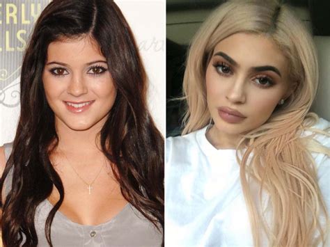 The biggest change in the youngest jenner sibling has been her pout. What now, Kylie Jenner? SEVEN times she's shocked us all