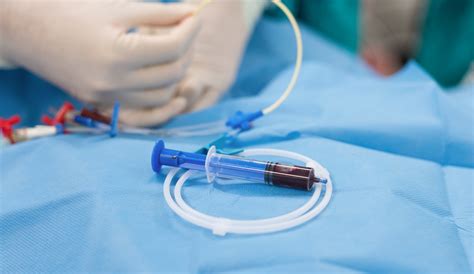 The Pros And Cons Of Vascular Surgery Health Care