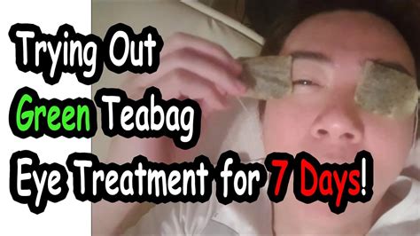 Trying Out Green Teabag Eye Treatment For 7 Days Youtube