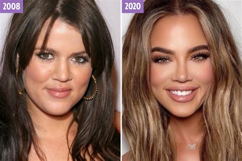 The Ever Changing Face Of Khloe Kardashian From Awkward Reality Tv