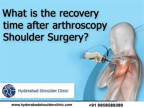 What Is The Recovery Time After Arthroscopy Shoulder Surgery