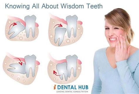 What To Do For Swelling After Wisdom Teeth Removal Whatdosd