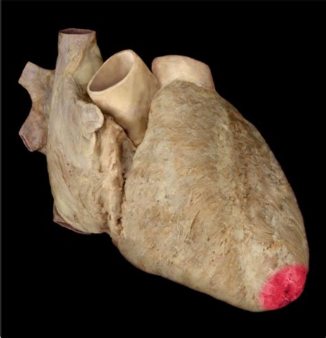 Aand P Lab Heart Cadaver Images Flashcards Quizlet
