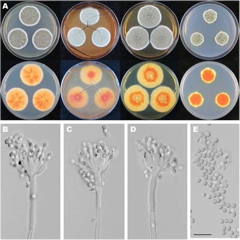 Colonial And Microscopic Morphology Of Penicillium Exsudans Hmas