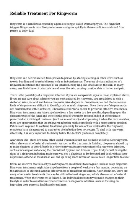 Reliable Treatment For Ringworm
