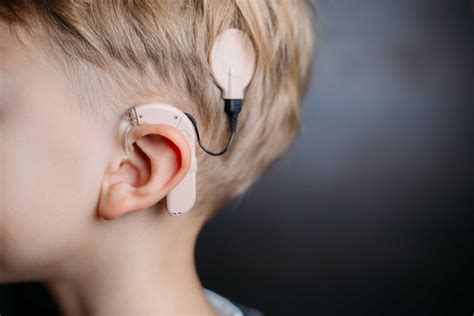 Deaf Children Still Need Speech Therapy Even With Cochlear Implants
