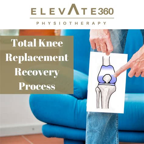 Total Knee Replacement Rehab Process Elevate Physiotherapy