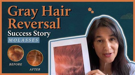 Gray Hair Reversal Success Story Proof With Blackstrap Molasses Youtube