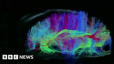 Brain Imaging Explores Treatments For Mental Illness Bbc News