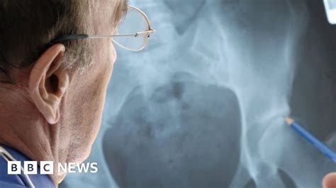 Hip Implant Patients Sue Manufacturer Bbc News