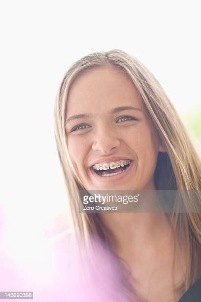 Pretty Girls With Braces Photos And Premium High Res Pictures Getty Images
