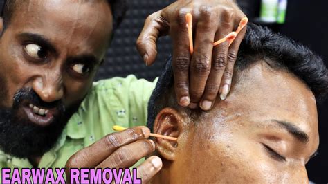 Massive Earwax Remove From Ear Ear Cleaning Asmr Head Massage