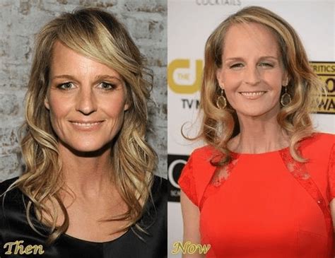 Helen Hunt Transformation Before And After Photos Otakukart