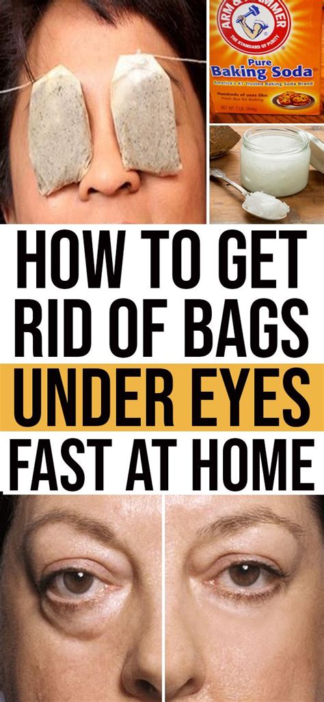 How To Get Rid Of Bags Under Eyes Fast With Home Remedies Eye Bags Treatment Undereye Eye Bags