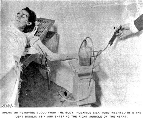 Embalmer Removing Blood From Corpse Courtesy Of The National Funeral