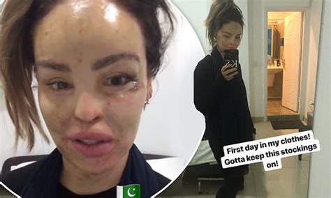 Katie Piper Is Recovering Well In Pakistan Hospital After Undergoing Operation Daily Mail Online