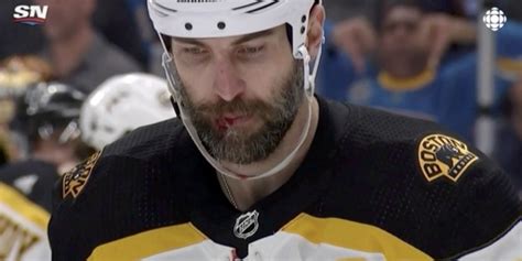 Zdeno Chara Bloodied Unable To Play Again After Deflected Shot Strikes