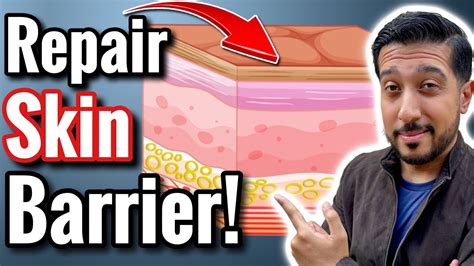 Fix A Damaged Skin Barrier How To Repair Skin Barrier Function Youtube