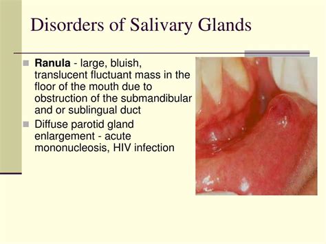 Ppt Diseases Of Oral Cavity Powerpoint Presentation Free Download