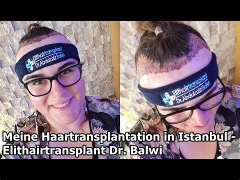 Meine Haartransplantation In Istanbul Elithairtransplant Dr Balwi
