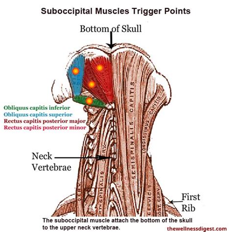 Suboccipital Muscles Headaches Migraines Eye Pain The Wellness Digest