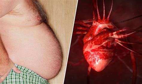 Heart Attack Symptoms More Likely With Fat In This Part Of The Body