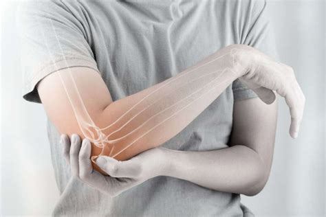 Broken Elbow 10 Broken Elbow Symptoms