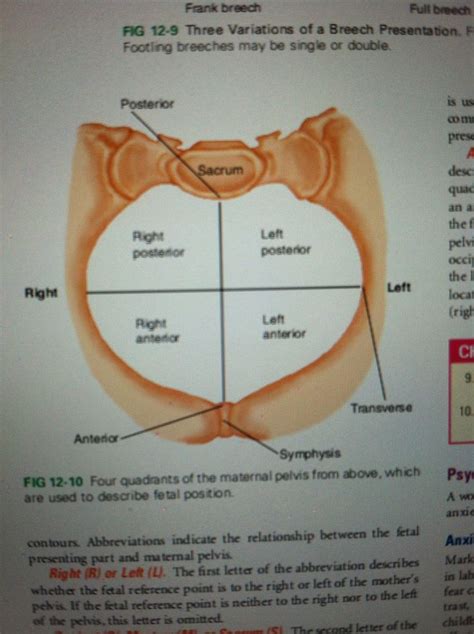 View an illustration that shows you the location of important structures such as the lobes, ducts, lymph nodes, and more. 39 best images about Midwifery on Pinterest | 14, Labor ...