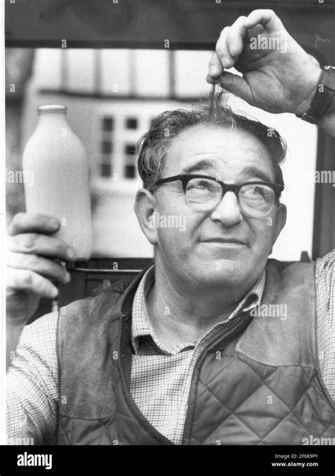 milkman harold bennett who s hair grew after he banged his head on his milk float pic mike