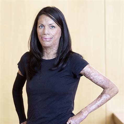 Turia Pitt Is The Nsw Woman Of The Year Freedom Live