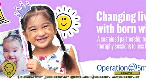 Johnson And Johnson Philippines Supports Operation Smile Phs Mission To