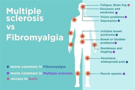 fibromyalgia vs multiple sclerosis ms differences in signs and symptoms