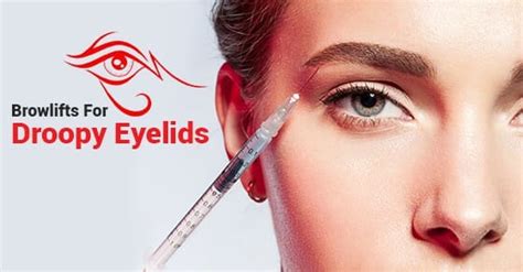 Botox Browlifts For Droopy Eyelids Dr Asif Pirani