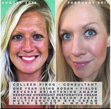 Amazing Results From Rodan And Fields Skincare Products Launching Here