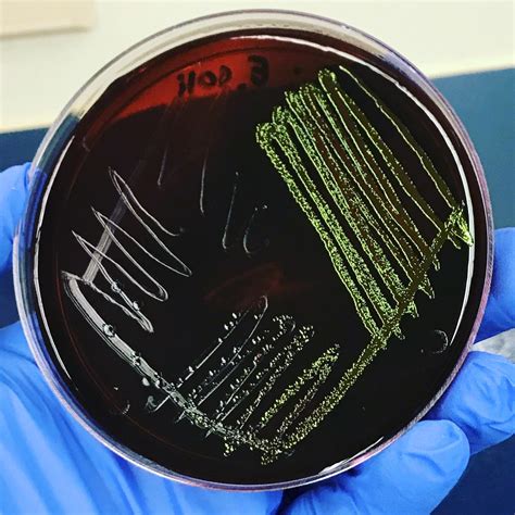 E Coli Streak On Emb Agar 48 Hour Incubation Rscienceimages