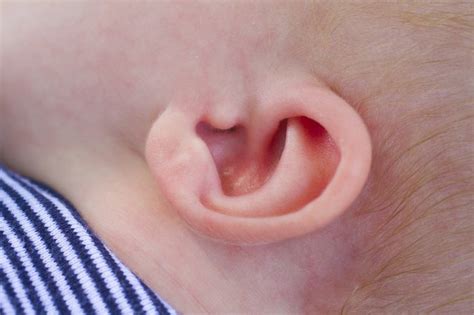 A Crease In An Infants Ear Livestrongcom
