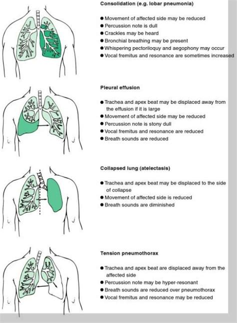 Signs Of Lung Disease On Physical Examination Nursing 101