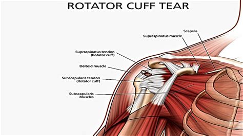 Tutorials on the shoulder muscles (e.g rotator cuff muscles: What to do about a rotator cuff injury - 50BOLD